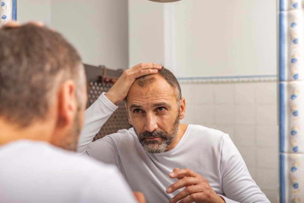 Queda de cabelo masculino tratamento caseiro
